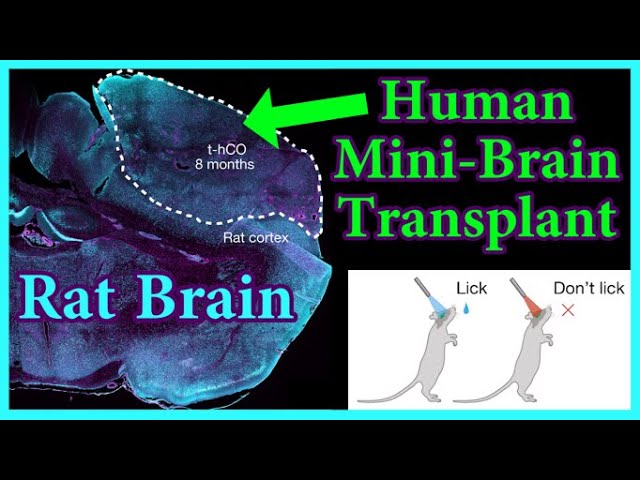 Scientists Gave Human Brain Cells to a Rat. Why?