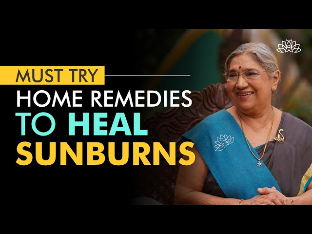 SunBurn Home Remedies | How to Treat SunTan Naturally at Home?