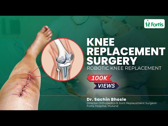 Knee Replacement के बाद क्या आप Normal लाइफ जी सकते है ? | TKR | Knee Replacement Surgery Cost | MUL
