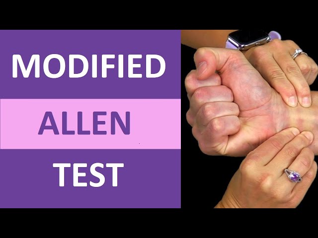 Modified Allen Test for Arterial Blood Gas (ABG) Procedure Collection Blood Draw