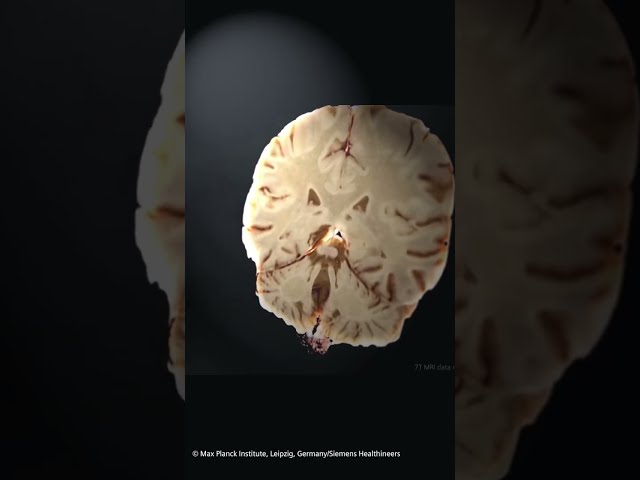 A look inside the human brain