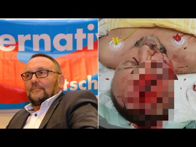 AfD Official Severely Beaten but Media Remains Largely Silent!!!