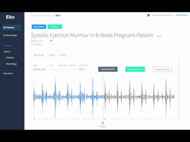 Systolic Ejection Murmur in 8-Weeks Pregnant Patient Recording & Waveform | Eko Health