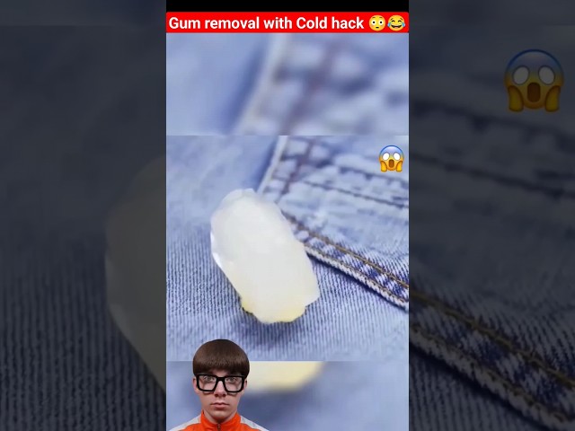 Gum removal with Cold hack 😳😂 #shorts