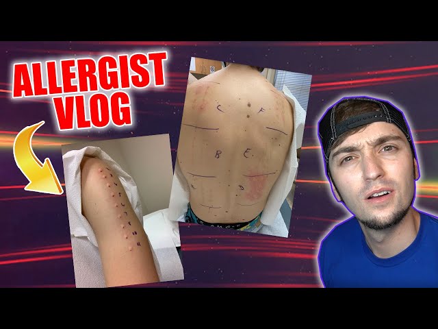 I WENT TO AN ALLERGIST AND IT WAS TORTURE (FRIDAY VLOG)