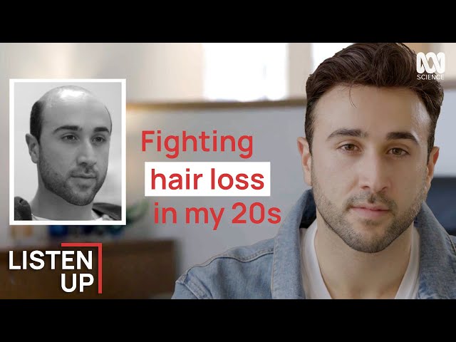 “I Started Losing My Hair At 20” | Listen Up | ABC Science