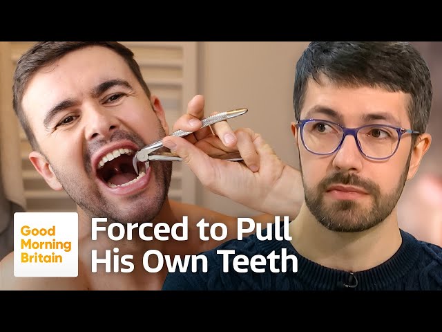 Dental Crisis: Patients Are Being Forced to Pull Out Their Own Teeth