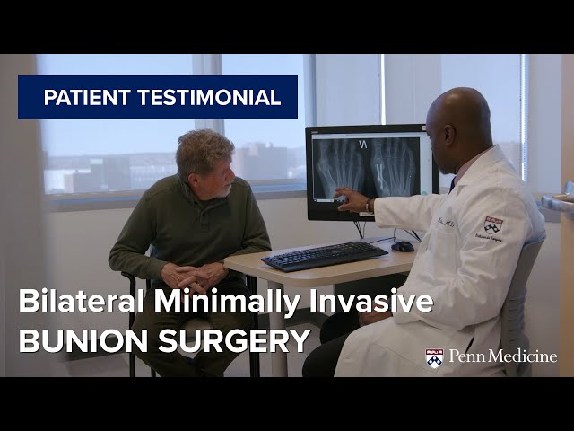 Bilateral Minimally Invasive Bunion Surgery Patient Testimonial | Penn Orthopaedics