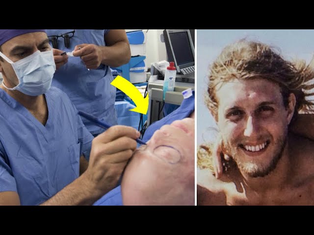 After A Risky 26-Hour Surgery, Burned Firefighter Looked Totally Unrecognizable
