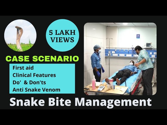 MBBS Case Scenario Snake bite management