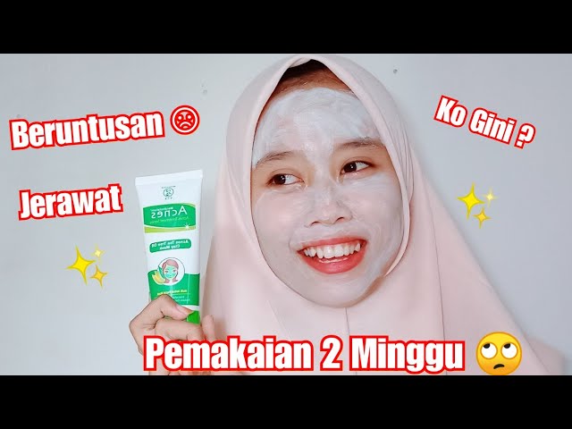 REVIEW ACNES CLAY MASK !!
