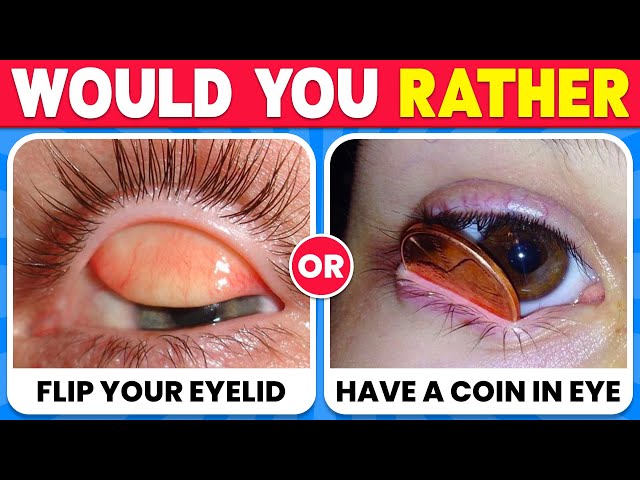 Would You Rather - Hardest Choices Ever! 😱⚠️