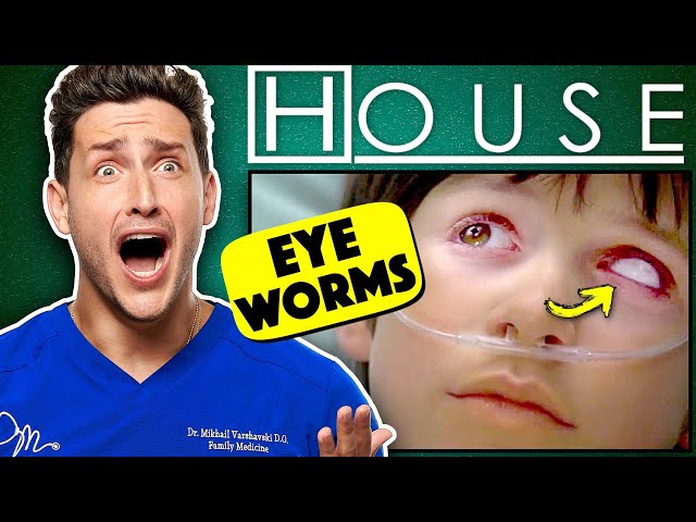 Doctor Reacts To House MD | "Eye Worms"