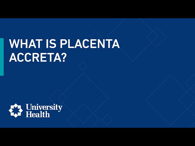 What is placenta accreta?