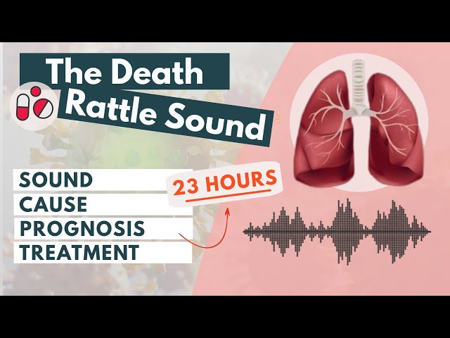 What does the death rattle sound like? | Signs of approaching death