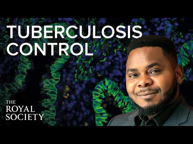 New tools to fight tuberculosis | The Royal Society