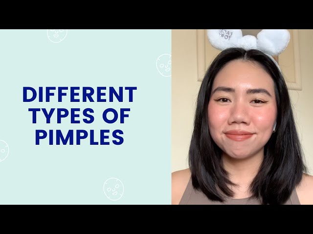 Different Types of Pimples | FaceTory