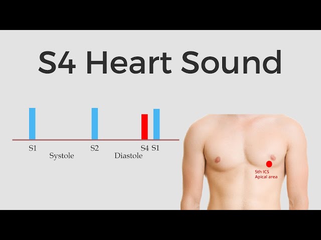 S4 Heart Sound