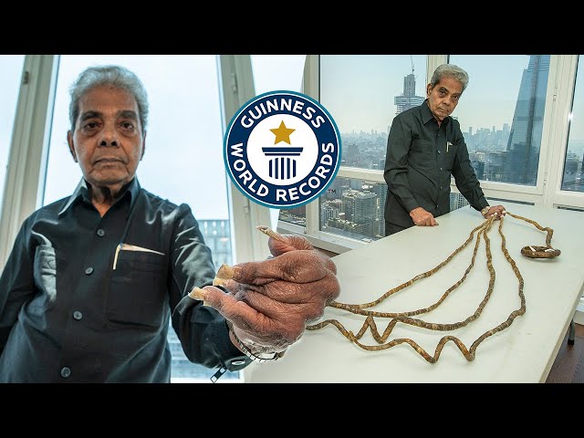 Why He Cut His Nails After 66 Years - Guinness World Records