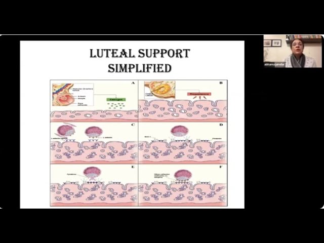 Luteal support, simplified!- IVF Lecture