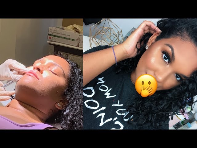 GETTING LIP INJECTIONS | MY EXPERIENCE | Natalia Garcia