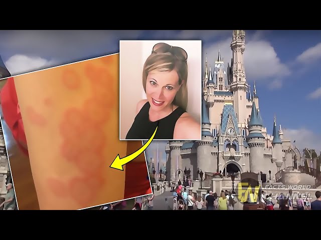 Family Was Being ‘Eaten Alive’ At Walt Disney World, Bitten 331 Times