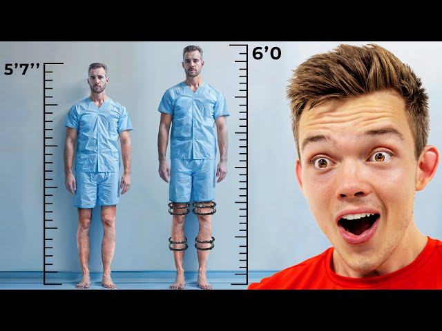 This Man Tried The $75,000 Surgery To Become Taller