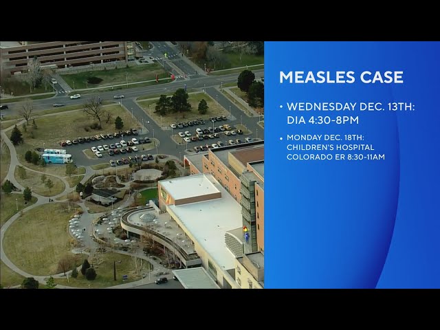 Measles case being treated in Colorado for the first time in 4 years