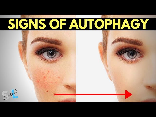 Signs of Autophagy - How to Know If You're In Autophagy