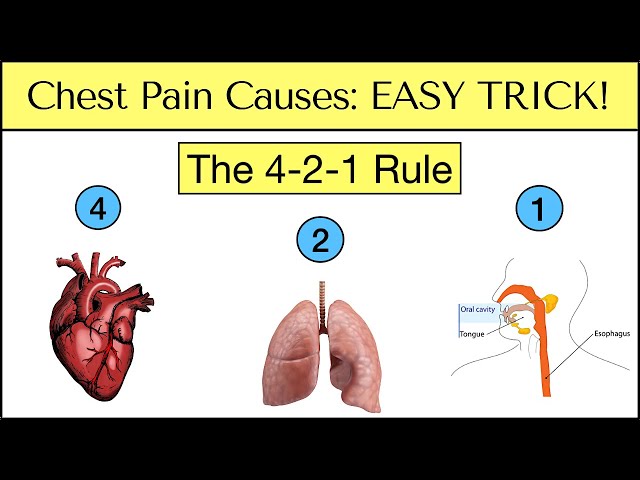 Causes of Chest Pain: EASY TRICK to Never Miss an Emergency [Must See]
