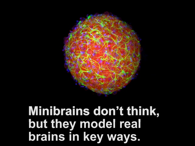 Minibrains at Brown University