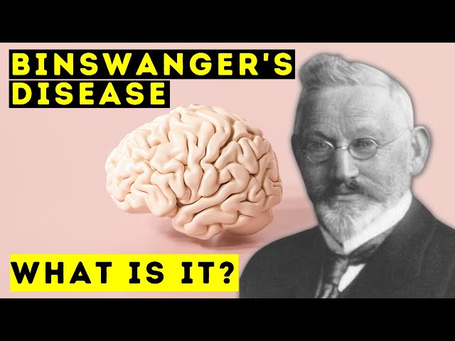 Binswanger's Disease - What is it? - Short Documentary