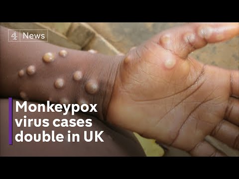 Monkeypox: 11 new cases confirmed in UK
