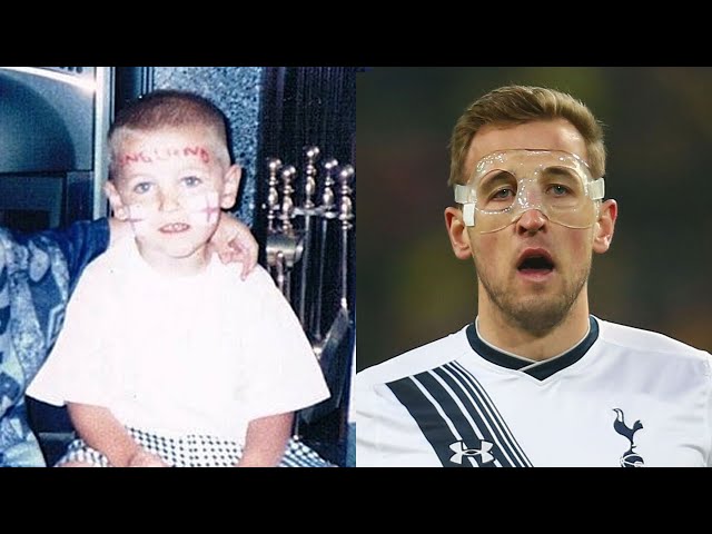 Harry Kane Transformation Then & Now (Body & Hairstyle & Tattoos)