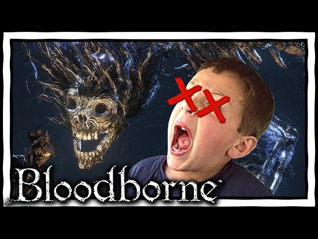 [SKIT] Gamer DIES Playing Bloodborne [Stream Highlight]