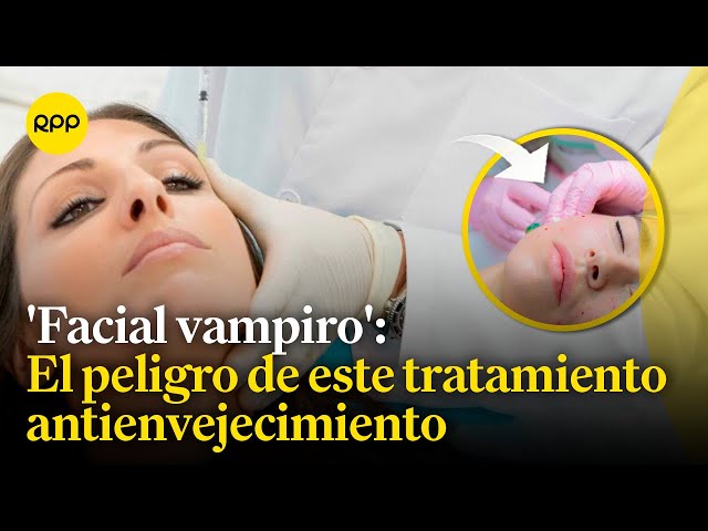 Tratamientos antienvejecimiento: Tres mujeres contrajeron VIH tras someterse al 'facial vampiro'