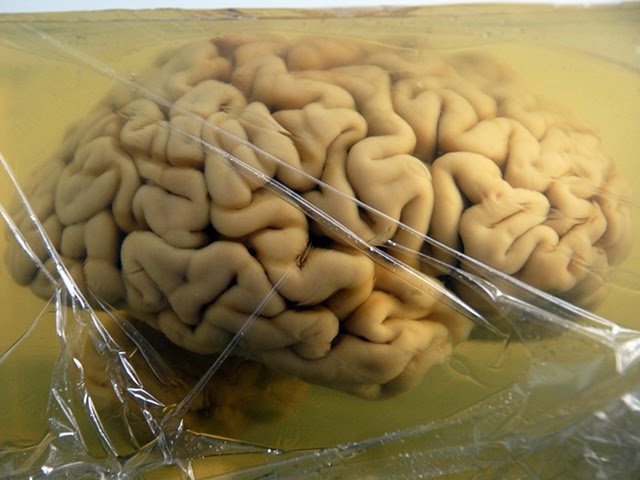 Slicing Up Human Brains -- Mind Blow #93