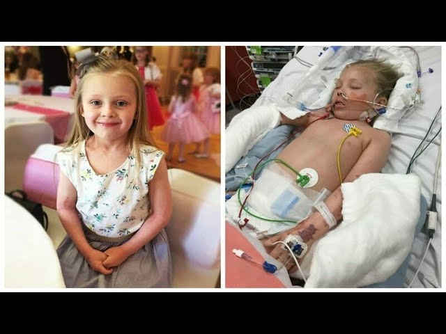 7-year-old’s “bruises” get worse – by the time her mother realizes the nasty truth, it’s too late