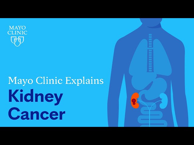 Mayo Clinic Explains Kidney Cancer
