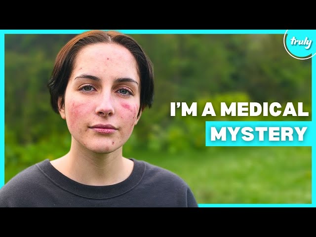 I'm Allergic To Myself | BORN DIFFERENT