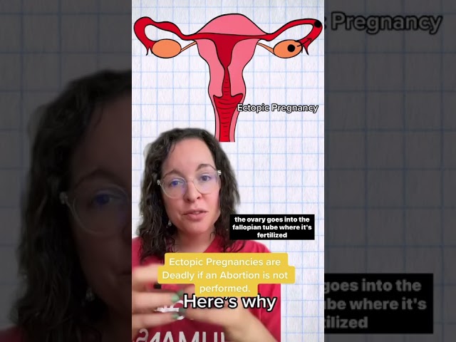 Ectopic pregnancies are deadly unless treated with Abortion. Here’s why.