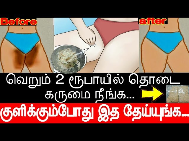 வெறும் 2 ரூபாயில் தொடை  கருமை நீங்க | How to Lighten Inner Thighs in Tamil | Thodai karumai poga