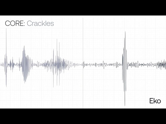 Crackles Recording & Waveform | Eko Health