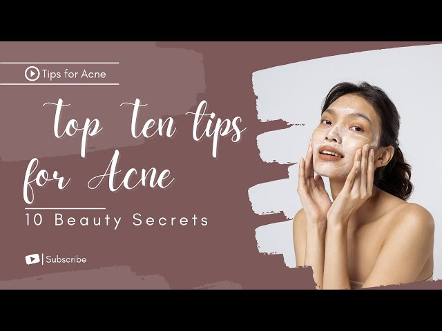 Top 10 tips for acne | Tips to prevent ance | Acne best tips | Beauty tips