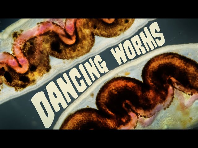 We Have No Clue Why These Worms Like To Dance