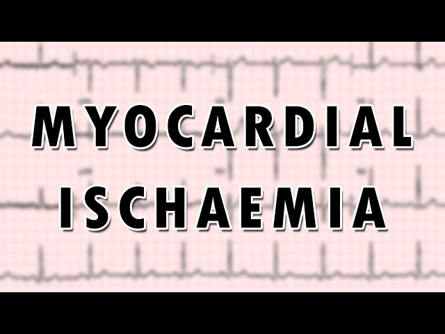 Myocardial Ischaemia