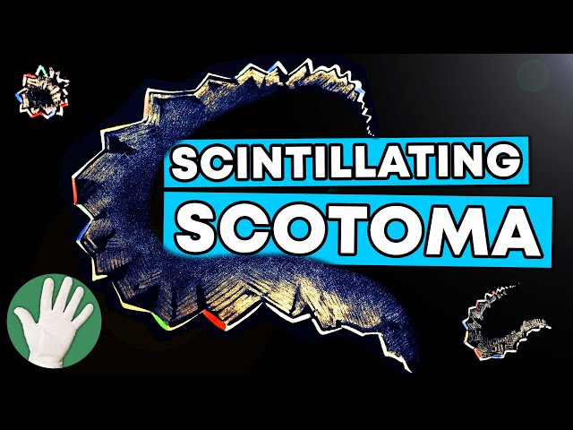 Scintillating Scotoma - Objectivity 255