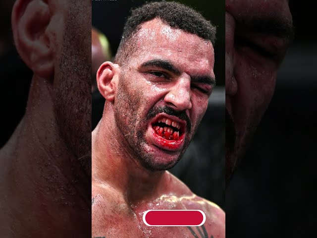 UFC Devin Clark Teeth Destroyed by Ion Cutelaba! 😱