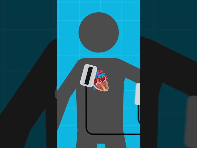 What Happens To Your Heart When A Defibrillator Is Used? #moviemyths #debunked #learnscience