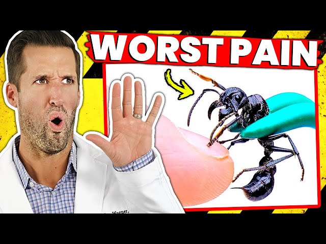 5 MOST PAINFUL Things You Can EVER Experience! (PART 2)
